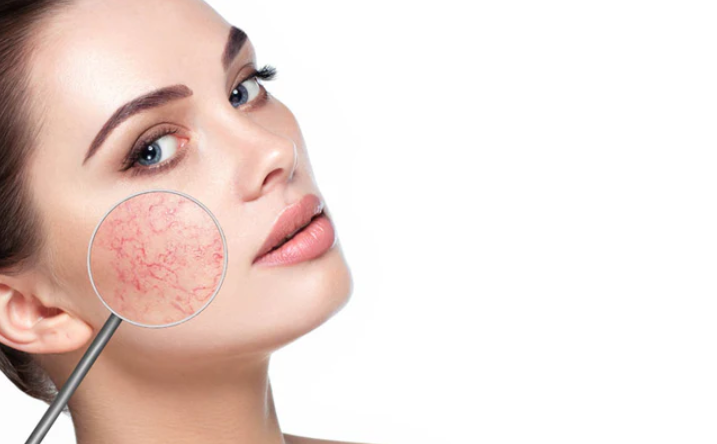 Best Korean Skincare Products for Dry and Sensitive Skin