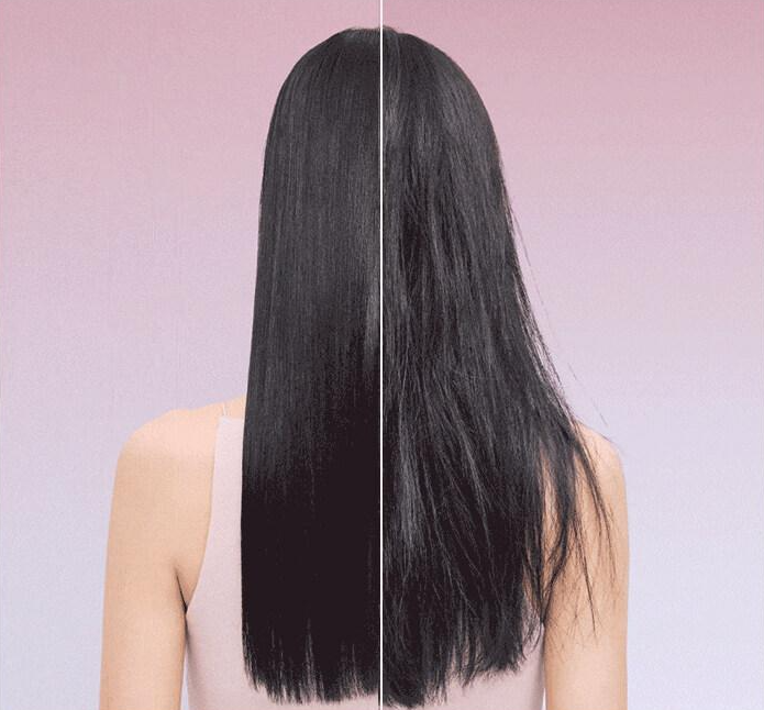 Hair loss
