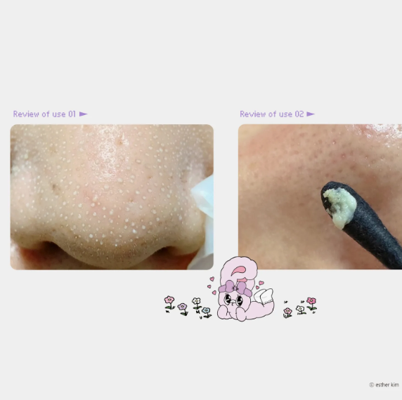 [ESTHER BUNNY EDITION] ilso Natural Mild Clear Nose Patch 5P